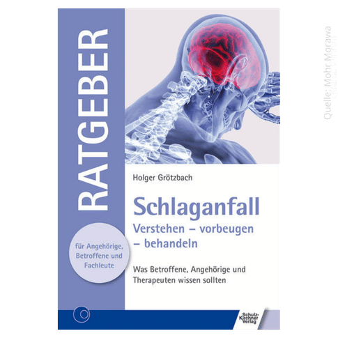 [300000035] Schlaganfall - Buch